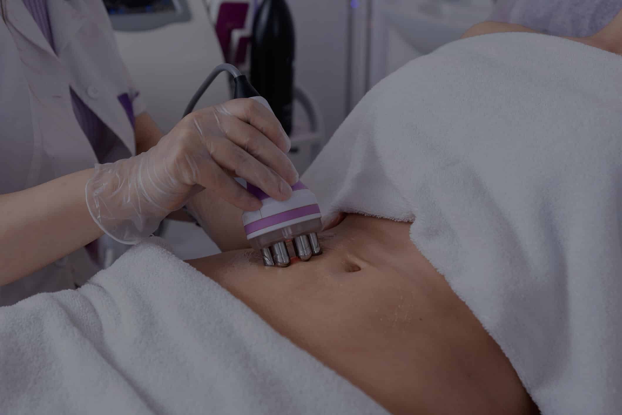radiofrequence-cavitation-ideal-clean-DR-wemmel